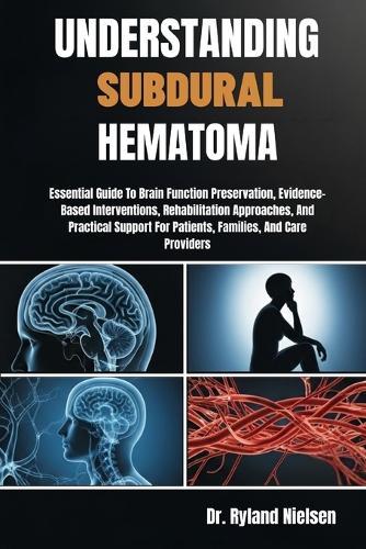 Understanding Subdural Hematoma: Essential Guide To Brain Function Preservation, Evidence-Based Interventions, Rehabilitation Approaches, And Practical Support For Patients, Families, And Care Providers