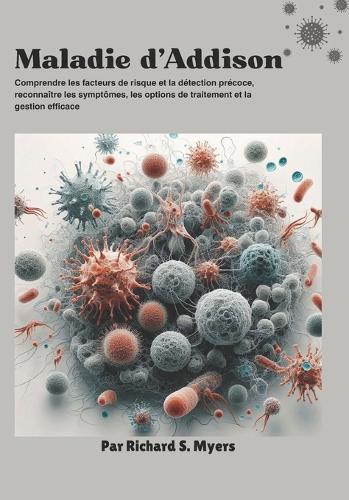Maladie d'Addison: Comprendre les facteurs de risque et la détection précoce, reconnaître les symptômes, les options de traitement et la gestion efficace