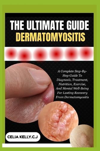 The Ultimate Guide Dermatomyositis: A Complete Step-By-Step Guide To Diagnosis, Treatment, Nutrition, Exercise, And Mental Well-Being For Lasting Recovery From Dermatomyositis