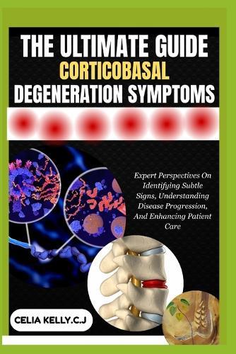 The Ultimate Guide Corticobasal Degeneration Symptoms: Expert Perspectives On Identifying Subtle Signs, Understanding Disease Progression, And Enhancing Patient Care