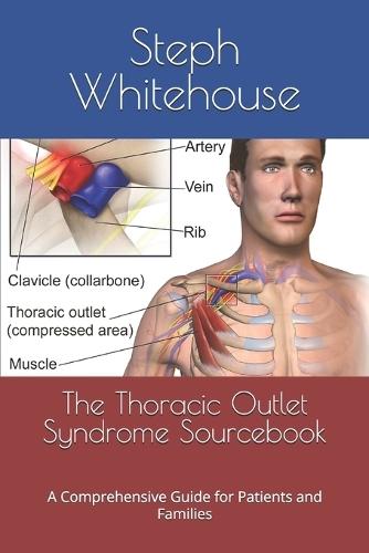 The Thoracic Outlet Syndrome Sourcebook: A Comprehensive Guide for Patients and Families