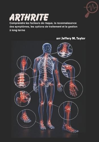 Arthrite: Comprendre les facteurs de risque, la reconnaissance des symptômes, les options de traitement et la gestion à long terme