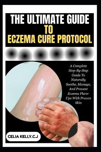 The Ultimate Guide to Eczema Cure Protocol: A Complete Step-By-Step Guide To Naturally Soothe, Manage, And Prevent Eczema Flare-Ups With Proven Skin