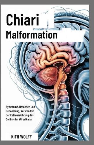 Chiari Malformation: Symptome, Ursachen und Behandlung, Verständnis der Fehlausrichtung des Gehirns im Wirbelkanal