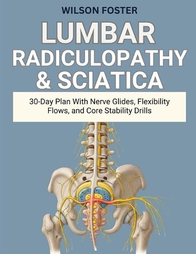 Lumbar Radiculopathy & Sciatica: 30-Day Plan With Nerve Glides, Flexibility Flows, and Core Stability Drills