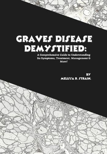 Graves Disease Demystified: A Comprehensive Guide to Understanding Its Symptoms, Treatment, Management & More!