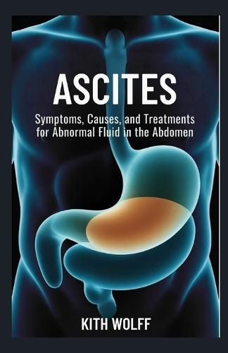 Ascites: Symptoms, Causes, and Treatments for Abnormal Fluid in the Abdomen