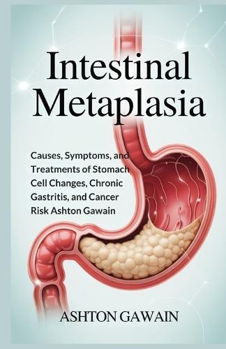 Intestinal Metaplasia: Causes, Symptoms, and Treatments of Stomach Cell Changes, Chronic Gastritis, and Cancer Risk