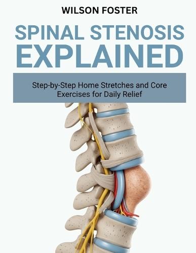 Spinal Stenosis Explained: Symptoms, Movement Tips, and Comfort Plans for Better Walking and Sleep