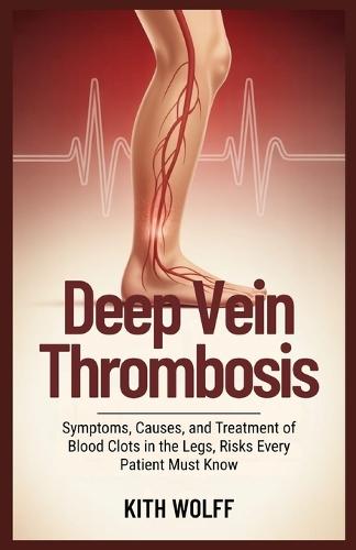 Deep Vein Thrombosis: Symptoms, Causes, and Treatment of Blood Clots in the Legs, Risks Every Patient Must Know