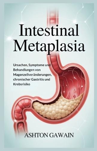 Intestinal Metaplasia: Ursachen, Symptome und Behandlungen von Magenzellveränderungen, chronischer Gastritis und Krebsrisiko
