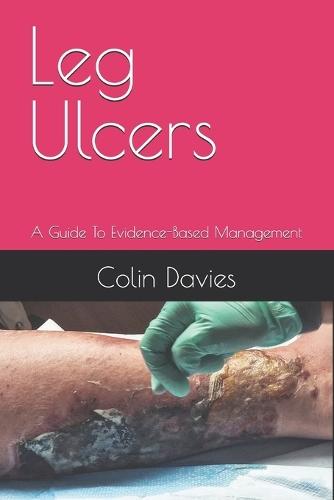 Leg Ulcers: A Guide To Evidence-Based Management