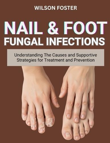 Nail & Foot Fungal Infections: Understanding The Causes And Supportive Strategies For Treatment And Prevention