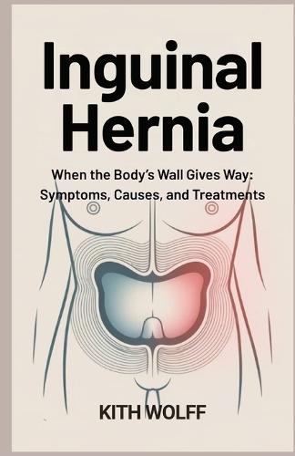 Inguinal Hernia: When the Body's Wall Gives Way: Symptoms, Causes, and Treatments