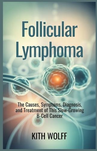 Follicular Lymphoma: The Causes, Symptoms, Diagnosis, and Treatment of This Slow-Growing B-Cell Cancer