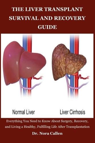 The Liver Transplant Survival and Recovery Guide: Everything You Need to Know About Surgery, Recovery, and Living a Healthy, Fulfilling Life After Transplantation