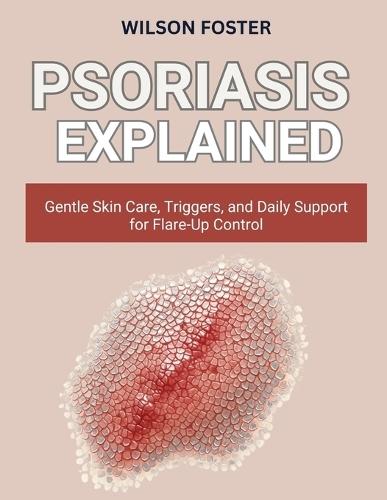 Psoriasis Explained: Gentle Skin Care, Triggers, and Daily Support for Flare-Up Control