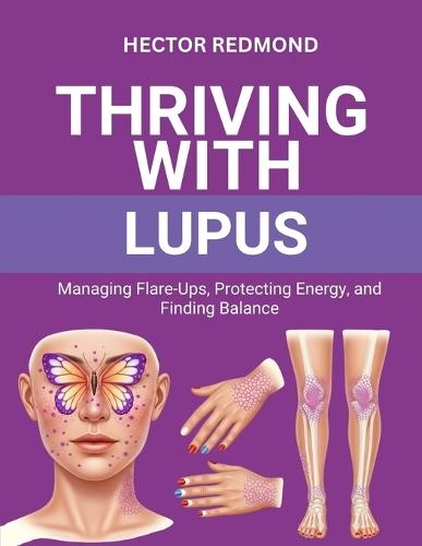 Thriving with Lupus: Managing Flare-Ups, Protecting Energy, and Finding Balance