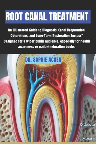 Root Canal Treatment: An Illustrated Guide to Diagnosis, Canal Preparation, Obturations, and Long-Term Restoration Success"" Designed for a wider public audience, especially for health awareness or patient education books.