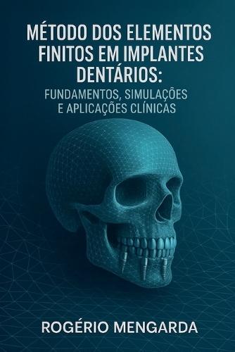 Método DOS Elementos Finitos Em Implantes Dentários: Fundamentos, Simulações E Aplicações Clínicasmétodo DOS Elementos Finitos Em Implantes Dentários