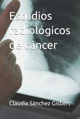 Estudios radiológicos de cáncer