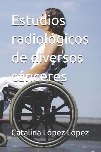 Estudios radiológicos de diversos cánceres