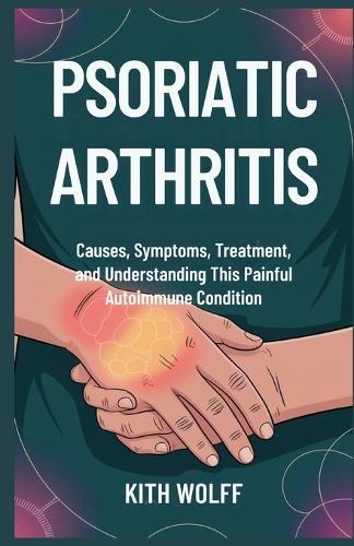 Psoriatic Arthritis: Causes, Symptoms, Treatment, and Understanding This Painful Autoimmune Condition