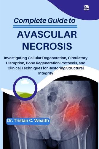 Complete Guide to Avascular Necrosis: Investigating Cellular Degeneration, Circulatory Disruption, Bone Regeneration Protocols, and Clinical Techniques for Restoring Structural Integrity