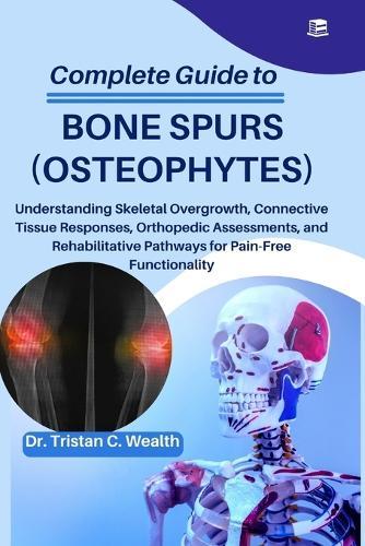 Complete Guide to Bone Spurs (Osteophytes): Understanding Skeletal Overgrowth, Connective Tissue Responses, Orthopedic Assessments, and Rehabilitative Pathways for Pain-Free Functionality