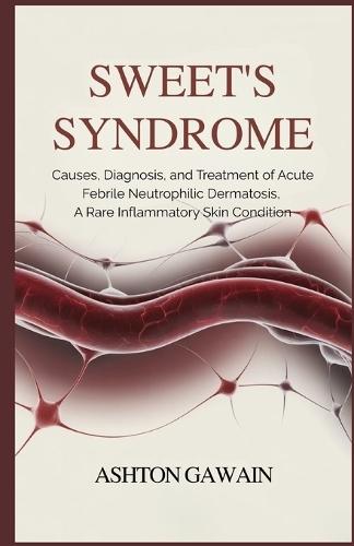 Sweet's Syndrome: Causes, Diagnosis, and Treatment of Acute Febrile Neutrophilic Dermatosis, A Rare Inflammatory Skin Condition