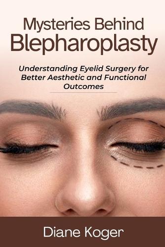 Mysteries Behind Blepharoplasty