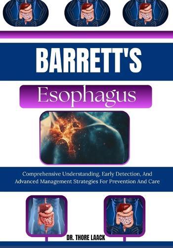 Barrett's Esophagus: Comprehensive Understanding, Early Detection, And Advanced Management Strategies For Prevention And Care