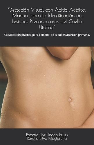 ""Detección Visual con Ácido Acético: Manual para la Identificación de Lesiones Precancerosas del Cuello Uterino"" Capacitación práctica para personal de salud en atención primaria.