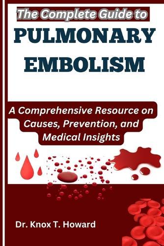 The Complete Guide to Pulmonary Embolism: A Comprehensive Resource on Causes, Prevention, and Medical Insights