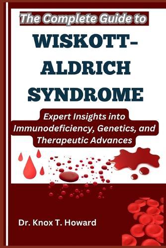 The Complete Guide to Wiskott-Aldrich Syndrome: Expert Insights into Immunodeficiency, Genetics, and Therapeutic Advances