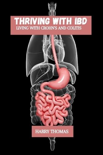 Thriving with IBD: Living with Crohn's and colitis