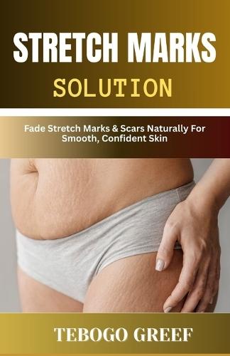 Stretch Marks Solution: Fade Stretch Marks & Scars Naturally For Smooth, Confident Skin