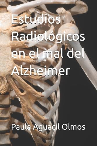 Estudios Radiológicos en el mal del Alzheimer
