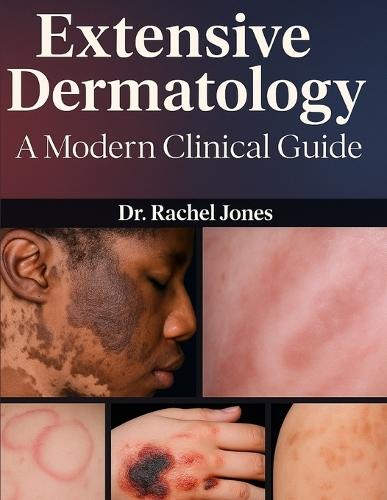 Extensive Dermatology: A Modern Clinical Guide