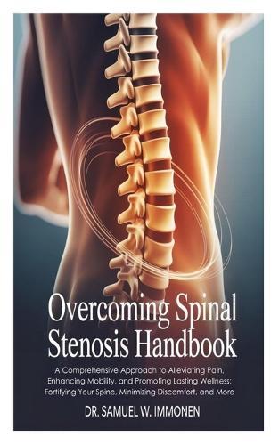 Overcoming Spinal Stenosis Handbook: A Comprehensive Approach to Alleviating Pain, Enhancing Mobility, and Promoting Lasting Wellness; Fortifying Your Spine, Minimizing Discomfort, and More