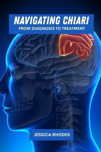 Navigating Chiari: From diagnosis to treatment