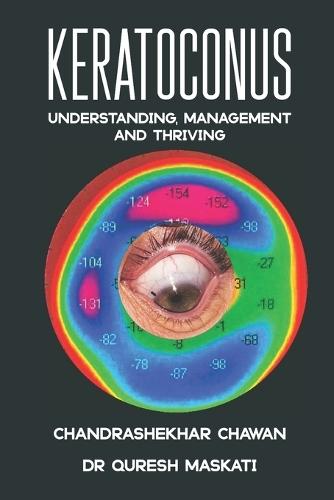 Keratoconus: Understanding, Managing, and Thriving,