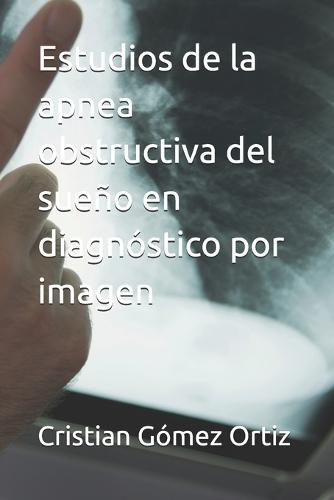 Estudios de la apnea obstructiva del sueño en diagnóstico por imagen