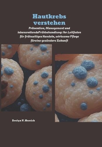 Hautkrebs verstehen: Prävention, Management und lebensrettendeFrühbehandlung: Ihr Leitfaden für frühzeitiges Handeln, wirksame Pflege füreine gesündere Zukunft