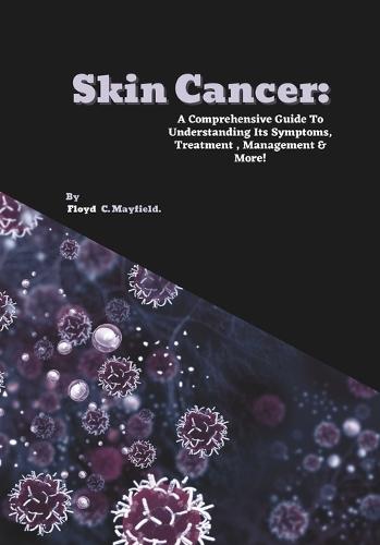 Skin Cancer: A Comprehensive Guide To Understanding Its Symptoms, Treatment, Management & More!