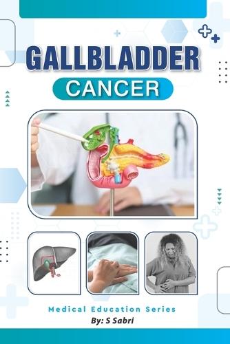 Gall Bladder Cancer