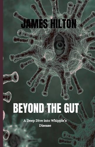 Beyond the Gut: A Deep Dive into Whipple's Disease