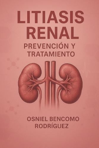 Litiasis Renal. Prevencion Y Tratamiento