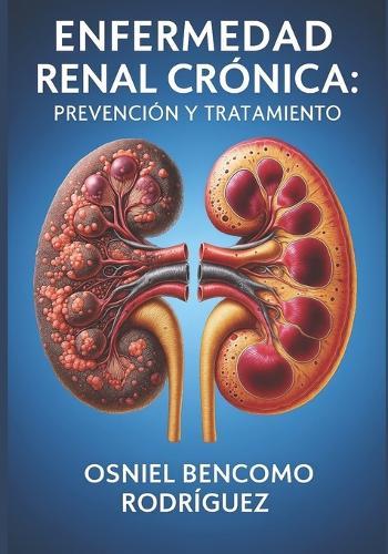 Enfermedad Renal Crónica. Prevención Y Tratamiento