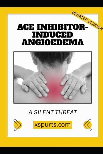 ACE Inhibitor-Induced Angioedema: A Silent Threat